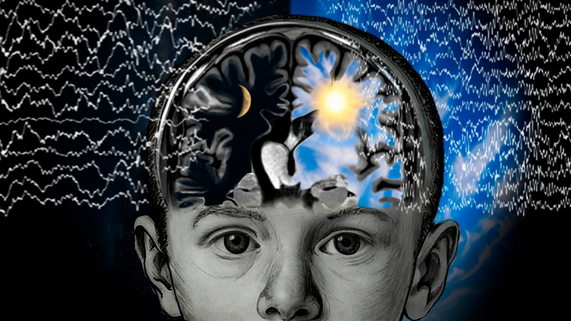 El cannabis terapéutico se emplea en epilepsias graves infantiles como el síndrome de Lennox-Gastaut, Dravet y esclerosis tuberosa. (Michele Colombo)