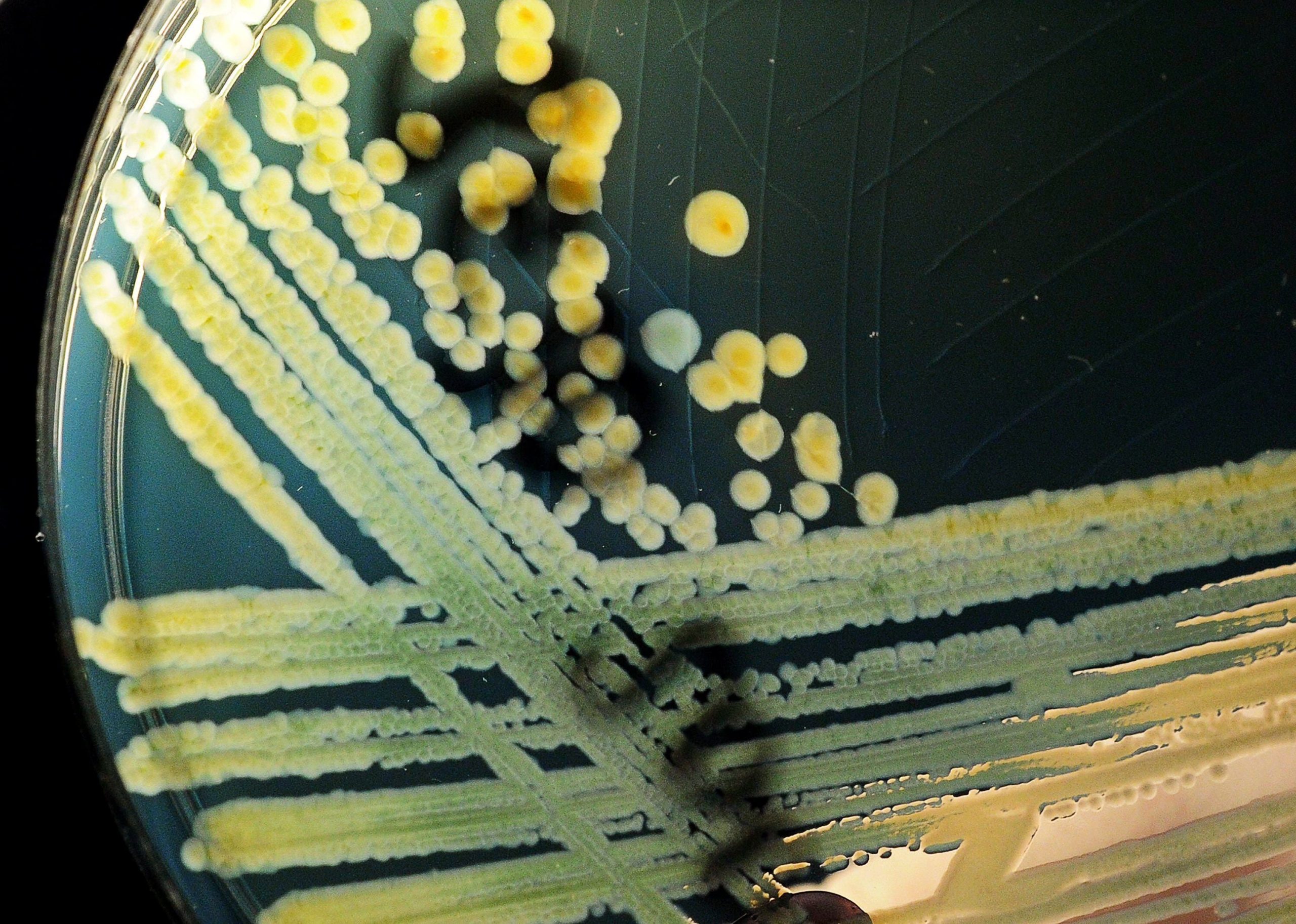 Las tetraciclinas permiten bloquear bacterias patógenas sin afectar a especies beneficiosas como Bacteroides dorei (EFE/JULIAN STRATENSCHULTE/ Archivo)