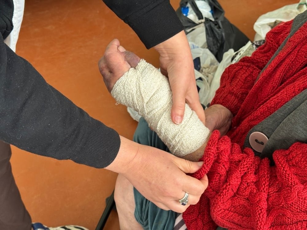 MSF ha tratado a más de 25.000 pacientes evacuados en los últimos tres años, más de la mitad con heridas causadas directamente por la violencia. Las lesiones más frecuentes son amputaciones de brazos y piernas por ataques de drones y metralla de bombas (Yuliia Trofimova/MSF)