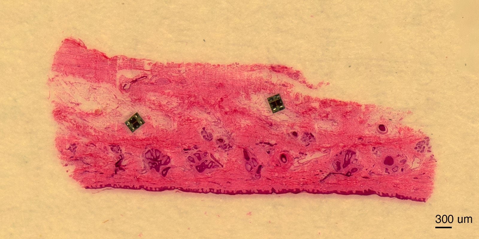 Estos dispositivos, del tamaño de un microorganismo, se propulsan con campos eléctricos y funcionan durante meses
Créditos: University of Pennsylvania