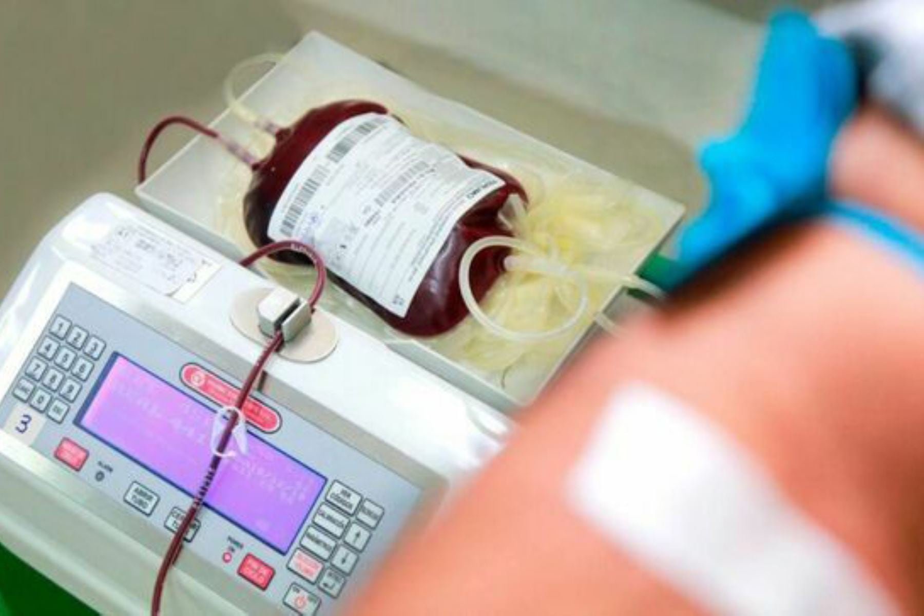 Vocero de EsSalud indicó que para donar sangre se debe tener un peso mínimo de 50 kilos y gozar de buena salud. (Andina)