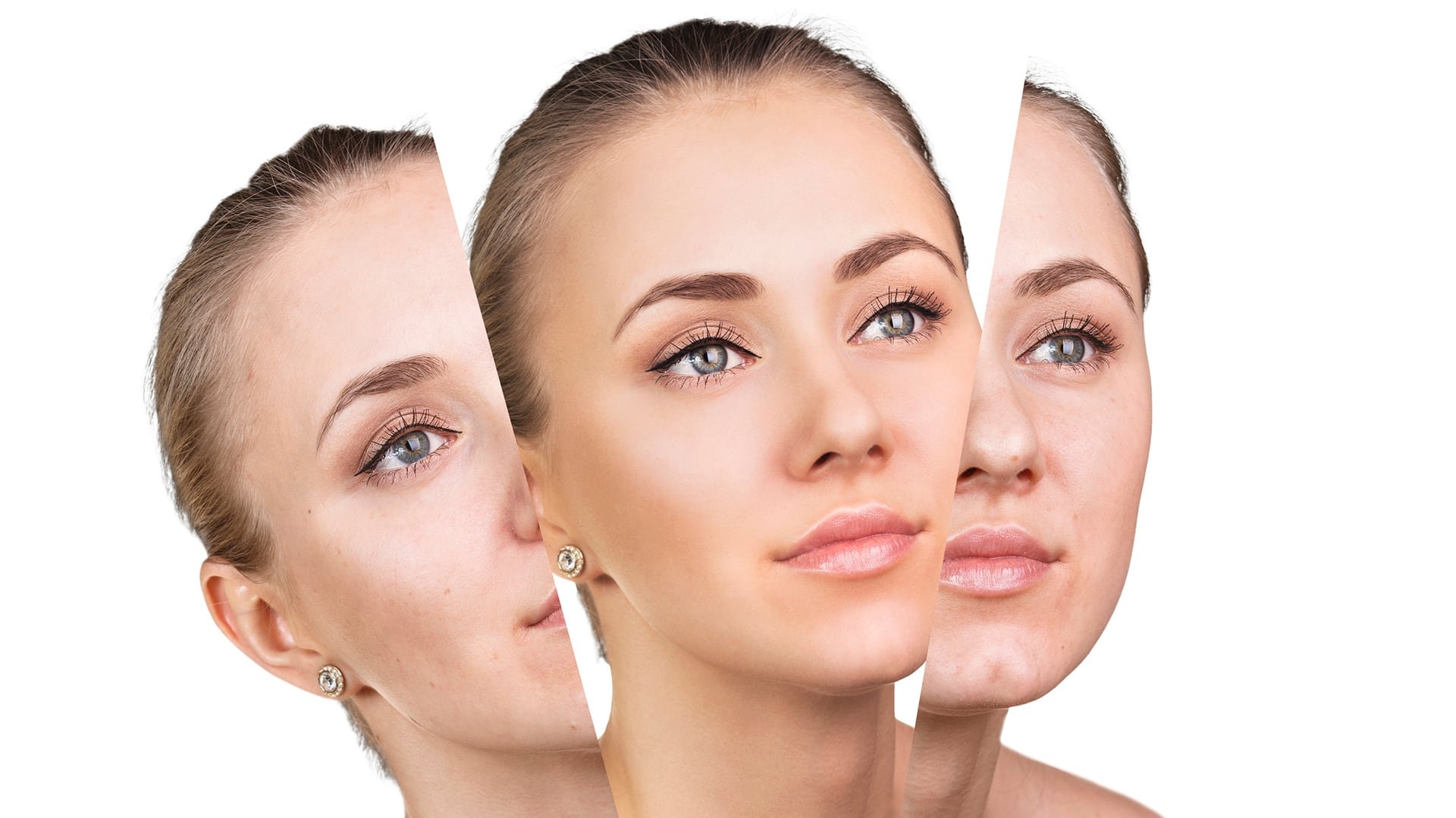 El aumento del grosor cutáneo se asocia con mayor producción de colágeno y aceleración en la renovación celular epidérmica (Istock)