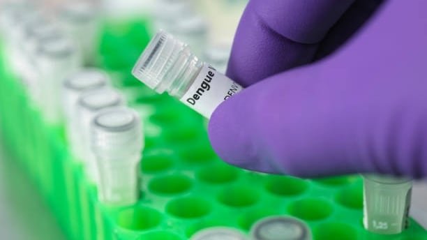 La vacuna TAK-003 logró reducir en un 84,1% las hospitalizaciones por dengue a 4,5 años de seguimiento, según estudios internacionales y evidencia local (Getty Images)