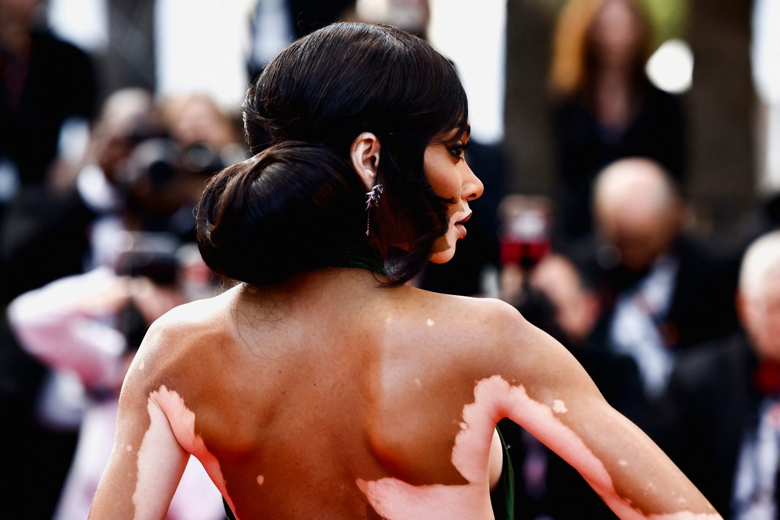 La presencia de Winnie Harlow en campañas internacionales impulsa la representación del vitiligo (REUTERS/Yara Nardi)