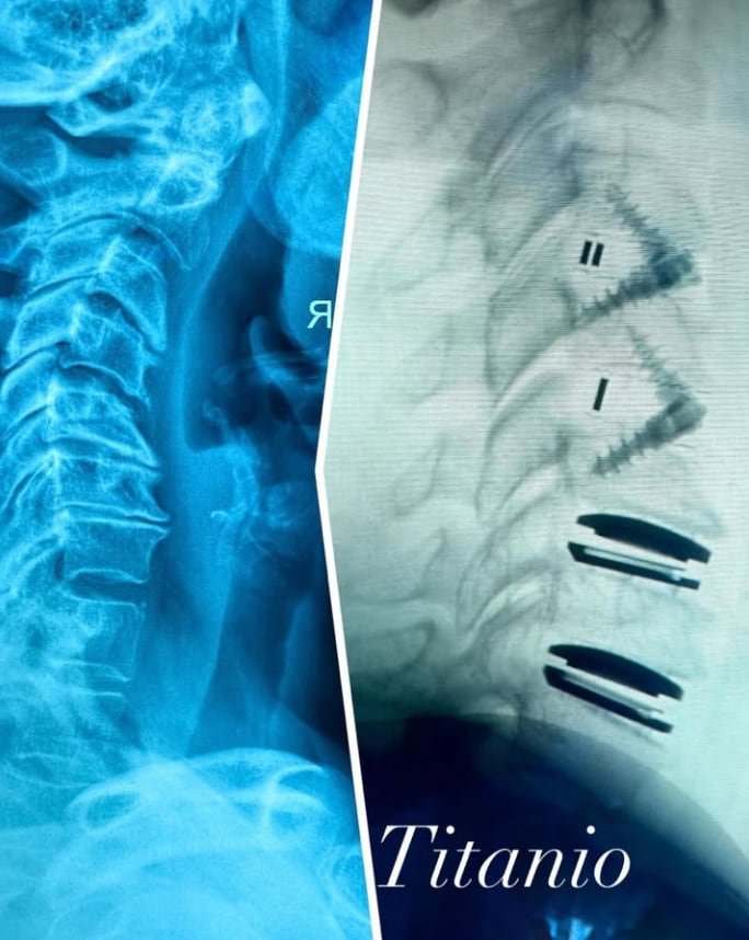 La salud de Alejandra Guzmán continuó preocupando a sus seguidores tras la cirugía que la mantuvo alejada de los escenarios durante 2025 (IG: @laguzmanmx)