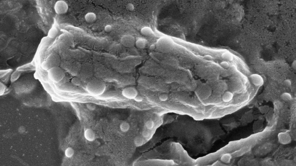 La investigación argentina permite disminuir las dosis necesarias de antibióticos como la colistina para tratar bacterias resistentes, al reducir la cantidad de antibiótico se minimizan los efectos secundarios tóxicos, entre ellos la nefrotoxicidad y la neurotoxicidad, que complican la atención de pacientes críticos