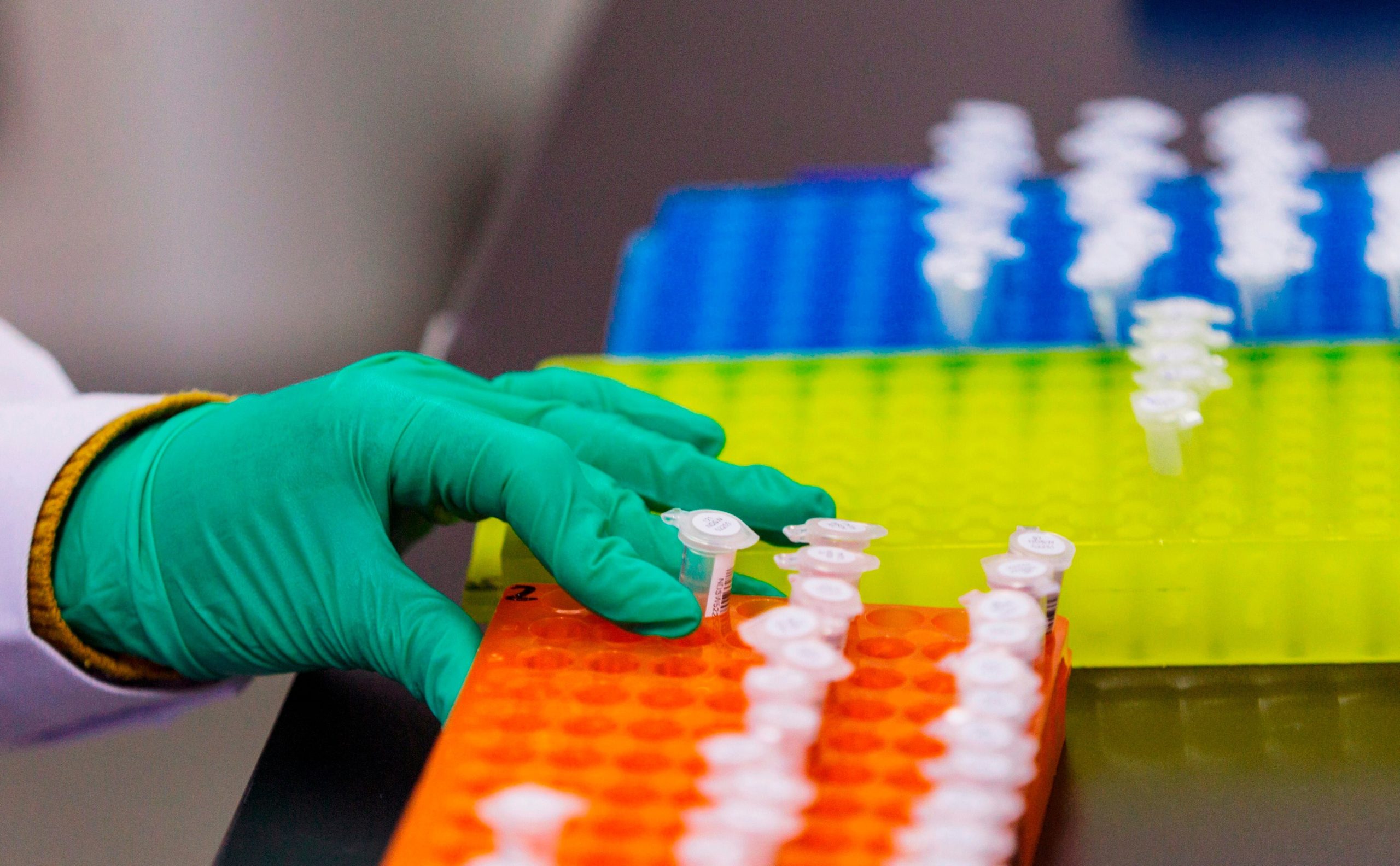 En el estudio, solo se analizaron síntomas depresivos y no se incluyeron aspectos maníacos del trastorno bipolar/Archivo EFE/ Aleksandar Plavevski/Archivo
