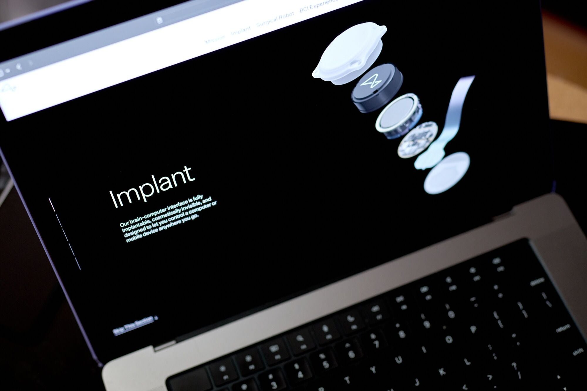 El chip de Neuralink permite mover un cursor, jugar videojuegos y navegar por Internet mediante señales cerebrales. (Bloomberg)