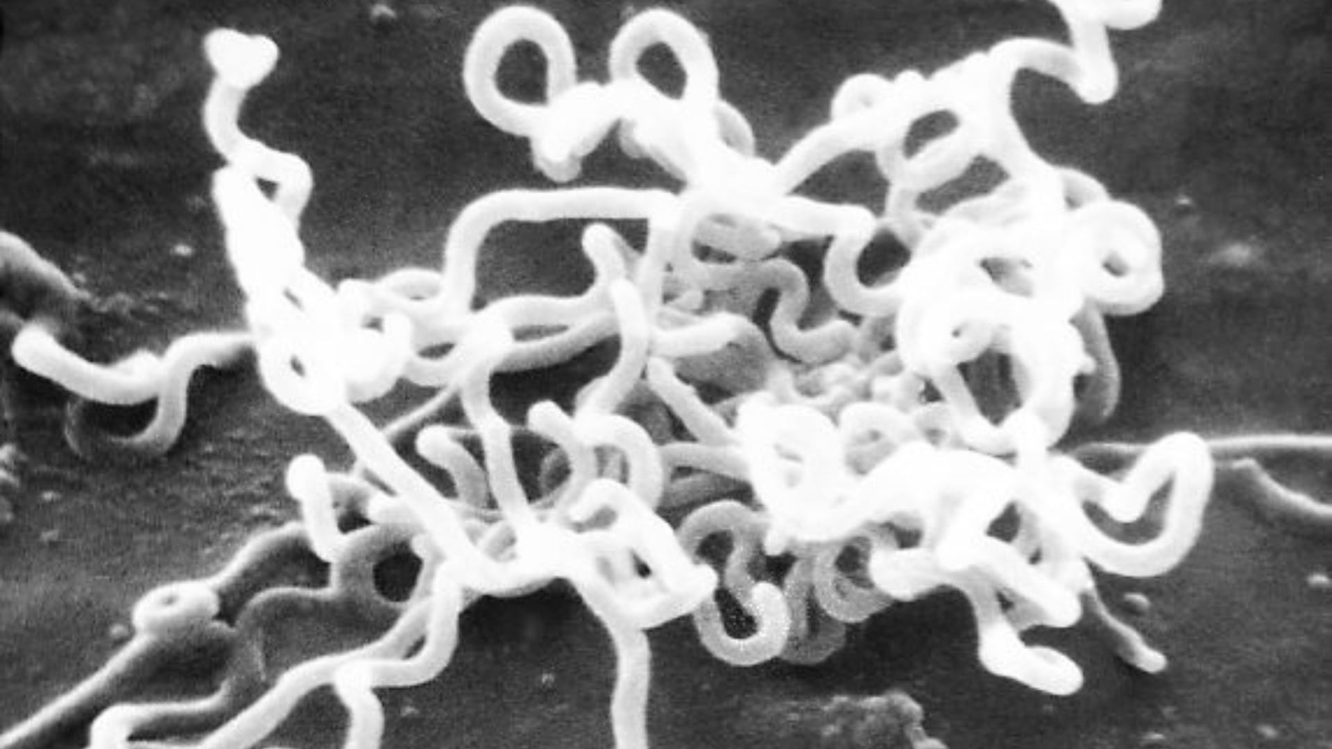 Investigadores demostraron que las treponematosis afectaron a cazadores-recolectores sudamericanos ya hace milenios, indicando un origen muy antiguo del patógeno (Wikipedia)