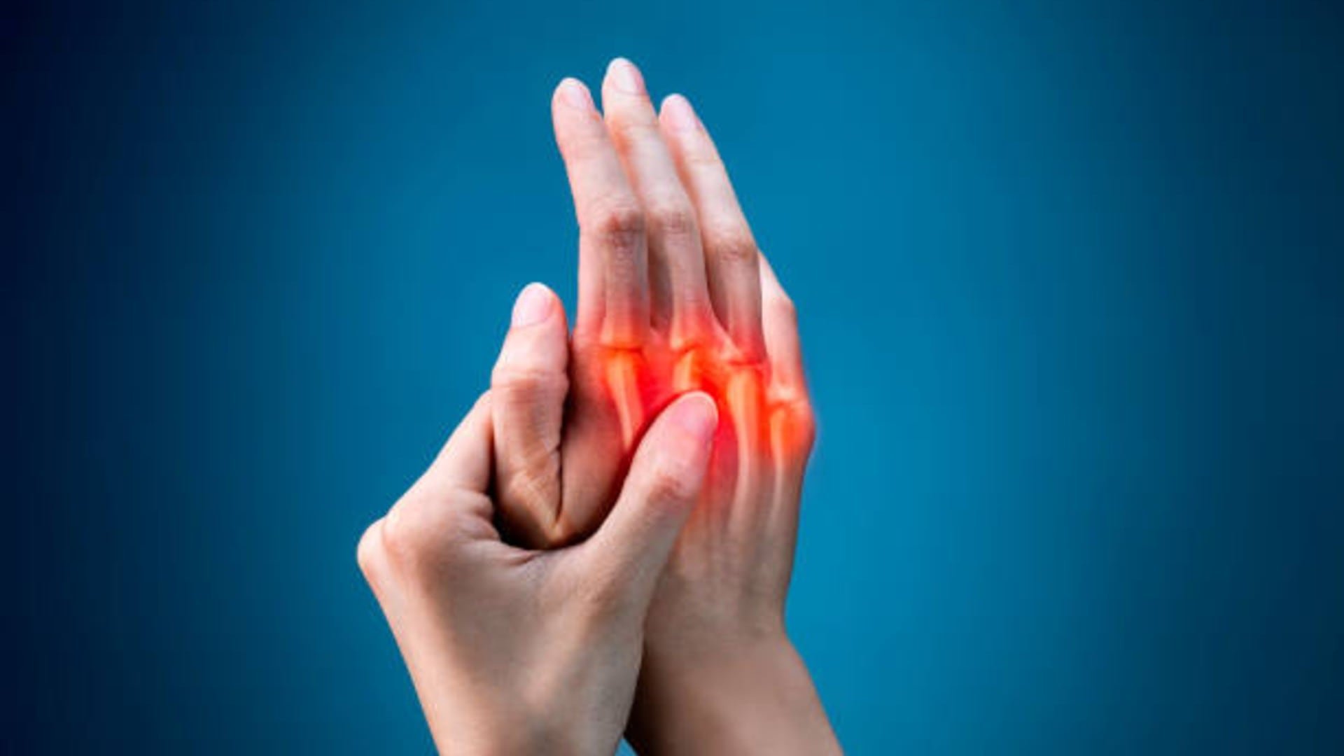 Reconocer síntomas como dolor, rigidez o pérdida de movilidad en articulaciones permite actuar antes de que la artrosis genere una disminución significativa en la capacidad de movimiento. Foto: (iStock)