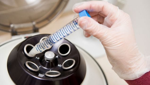 El estudio plantea que la acumulación de ARN largo en la cabeza del espermatozoide es un marcador clave del envejecimiento reproductivo masculino (Freepik)