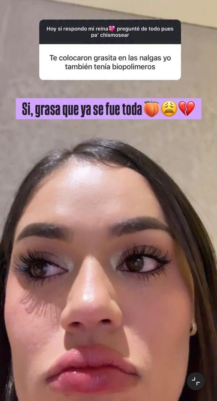 La Segura contó qué pasó con la grasa que le inyectaron en sus glúteos - crédito @lasegura.2/IG