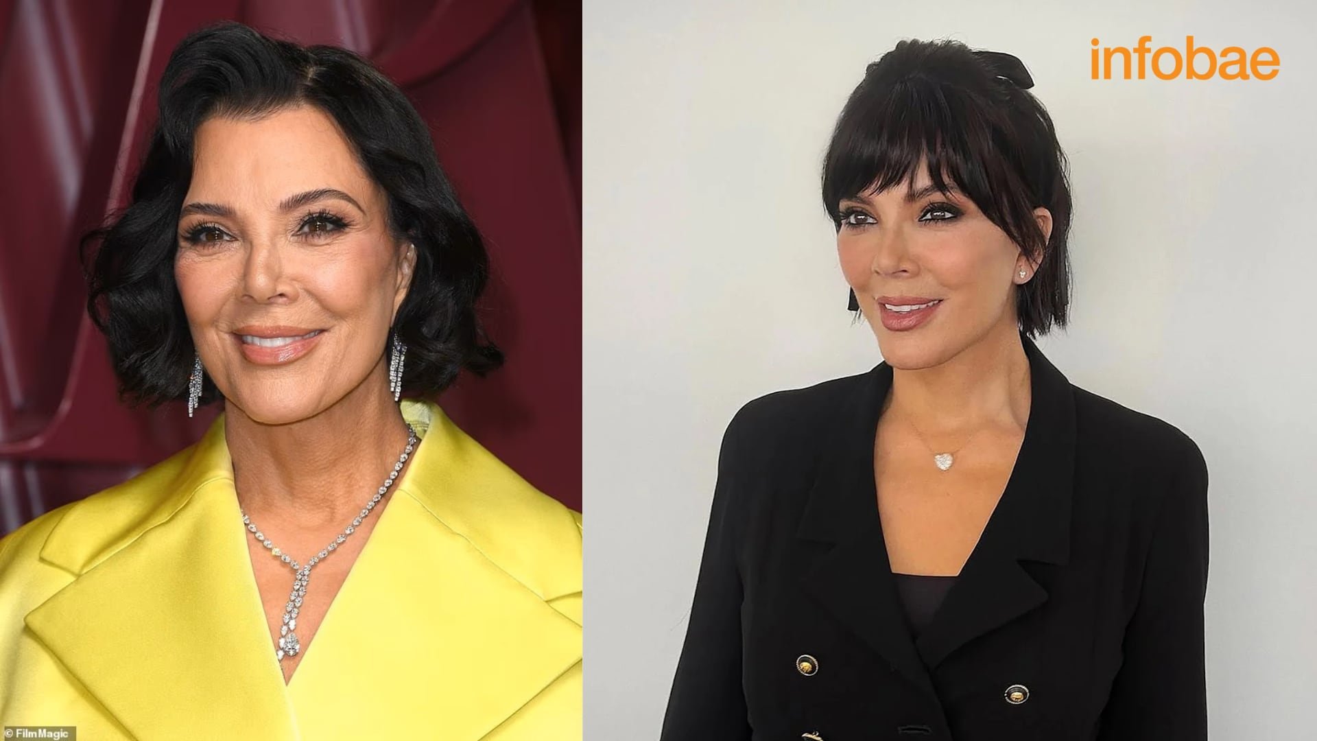 Kris Jenner se sometió a Lifting facial (Composición Infobae)
