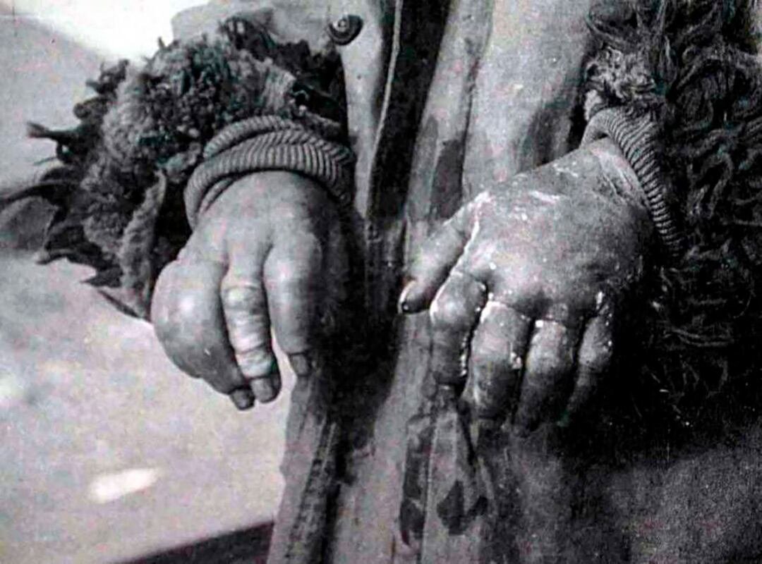 Los prisioneros eran sometidos a experimentos extremos de congelamiento de sus manos