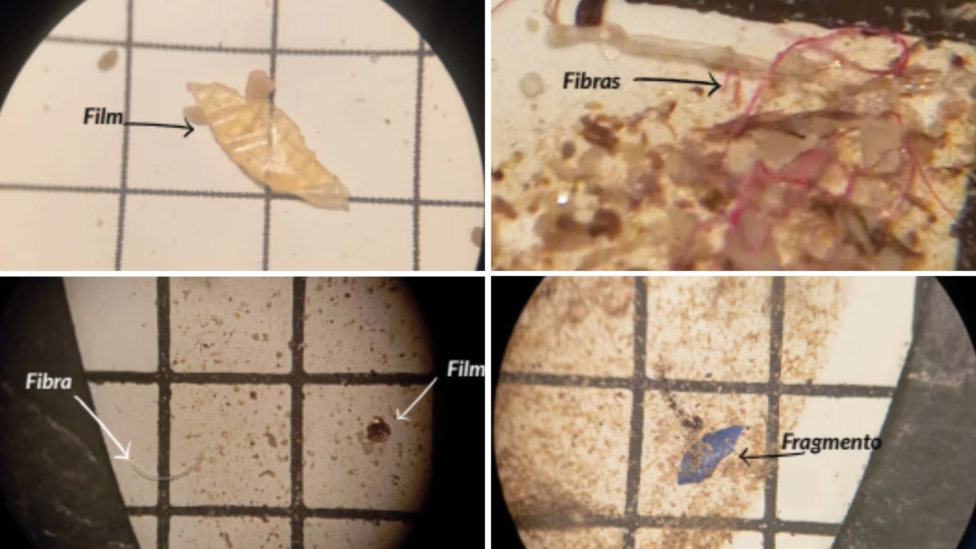 Cinco años de estudio demuestra que la mayoría de entornos acuáticos están contaminados de microplásticos en España (Montaje Infobae, Informa RED DE MONITOREO DE MICROPLASTICOS)