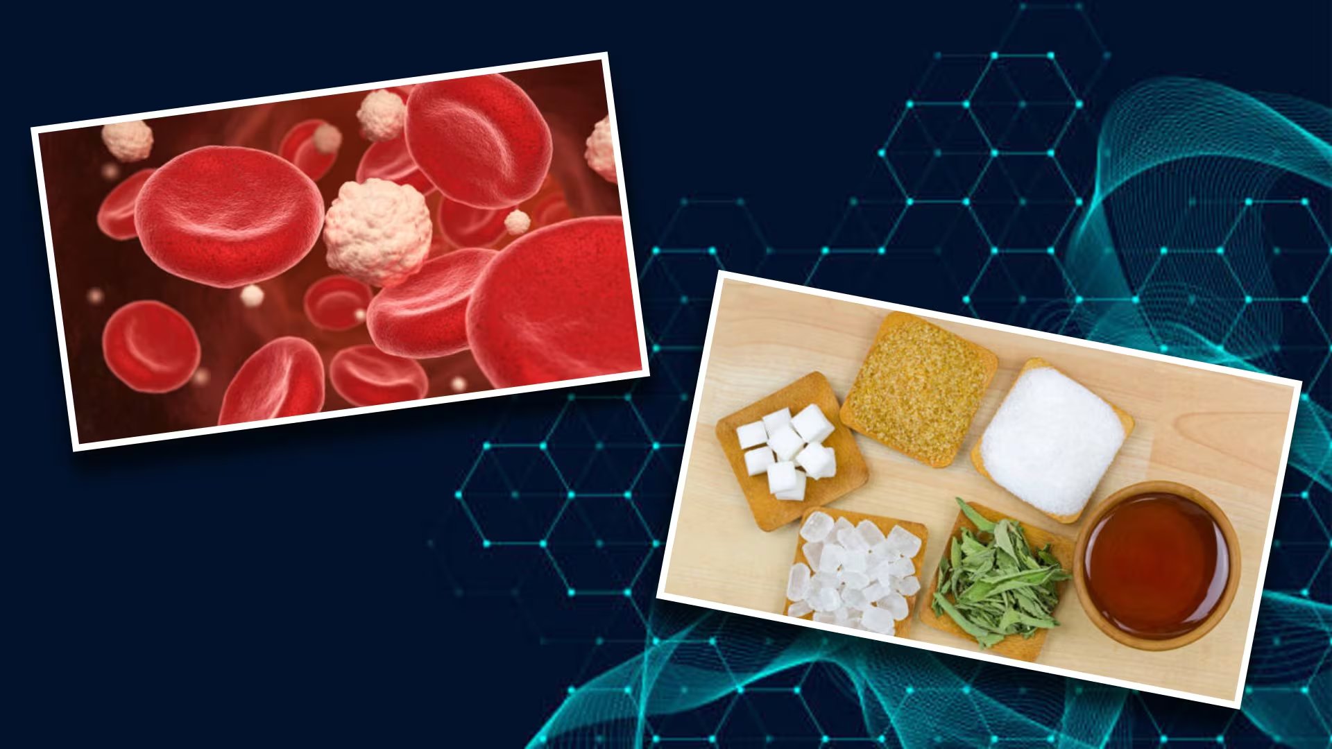 Fibra primero y carbohidratos al final: la clave para controlar los picos de glucosa. Foto: (Jesús Tovar Sosa/Infobae)