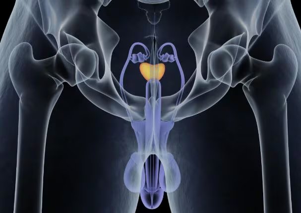 Síntomas iniciales que deben vigilar los hombres