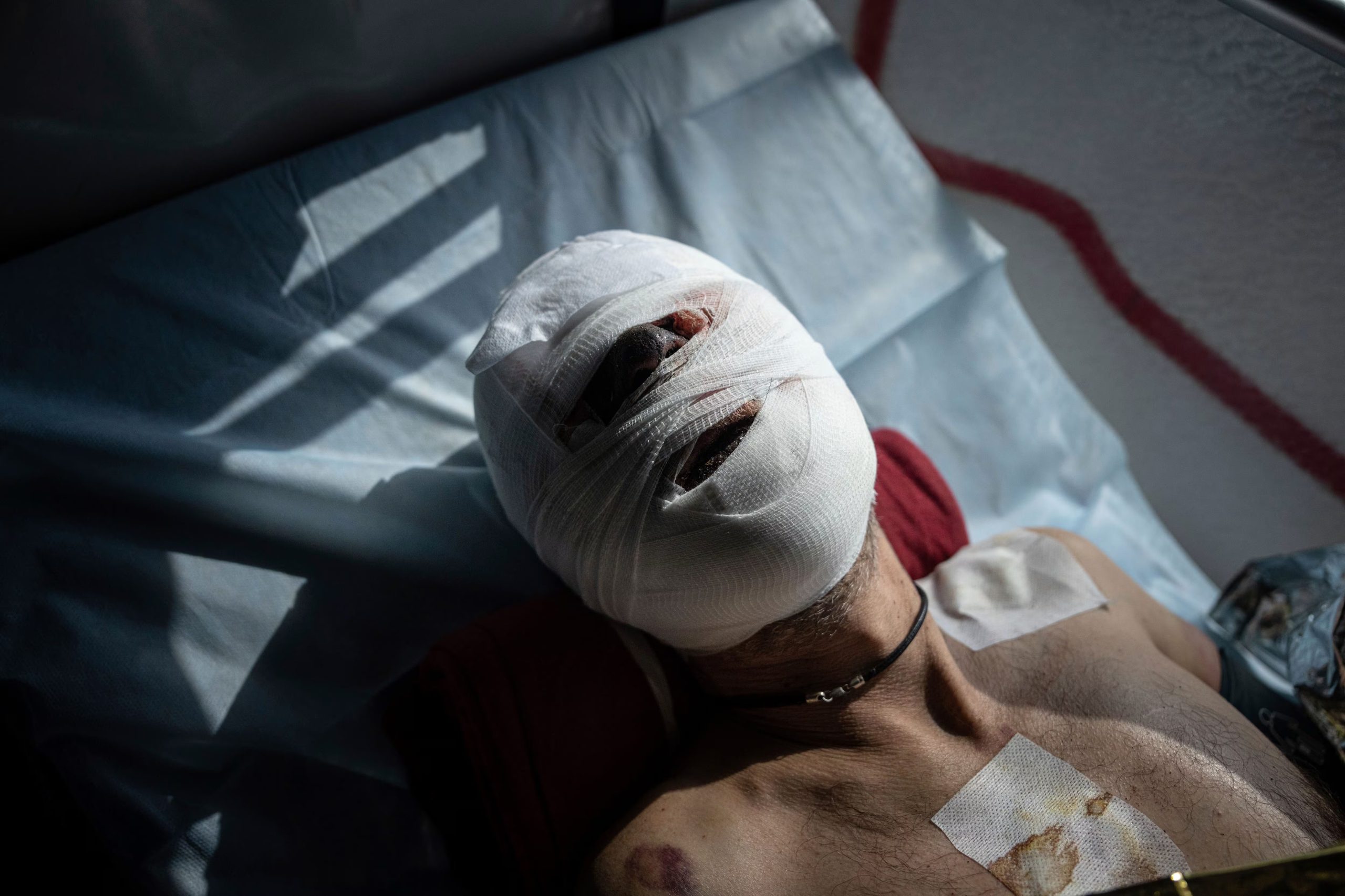 Un soldado ucraniano herido yace en un autobús de evacuación médica operado por voluntarios de la organización de paramédicos Hospitallers en Donetsk, Ucrania, el miércoles 22 de marzo de 2023 (AP/Evgeniy Maloletka, Archivo)