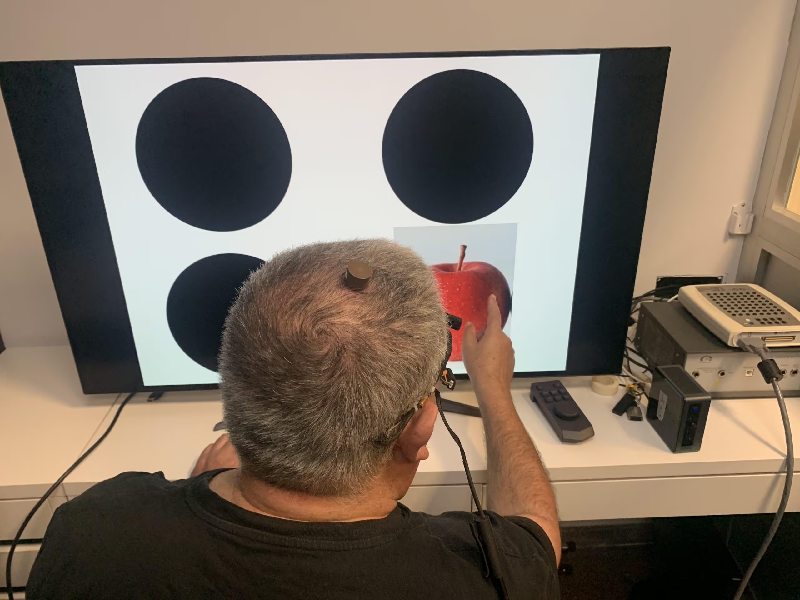 El sistema de microelectrodos implantado en la corteza visual permitió que el paciente perciba destellos de luz, formas simples y movimientos tras tres años de oscuridad total (Créditos: Universidad Miguel Hernández de Elche)