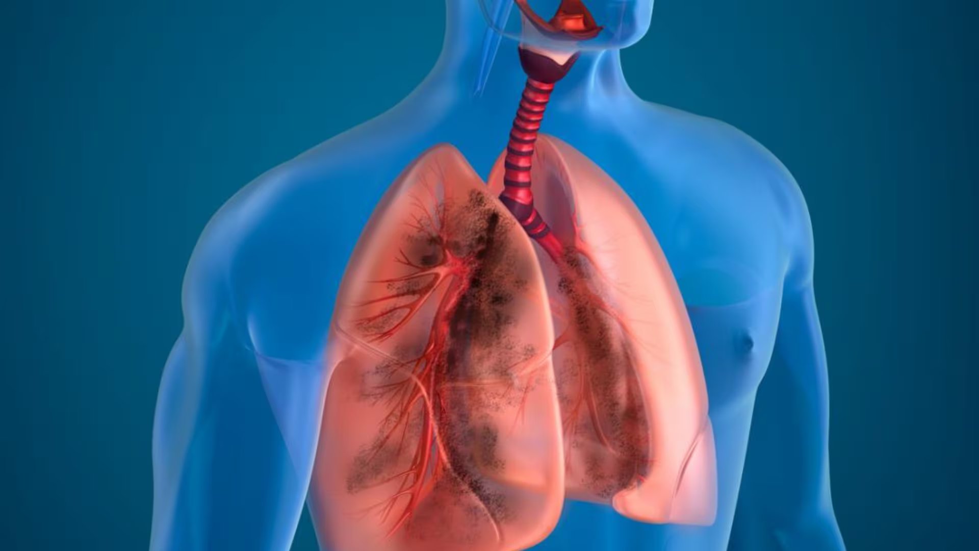 Entre las causas respiratorias del dolor torácico destacan el broncoespasmo, la pleuresía, el neumotórax y la embolia pulmonar, algunos requieren intervención médica inmediata (Medical News Today)
