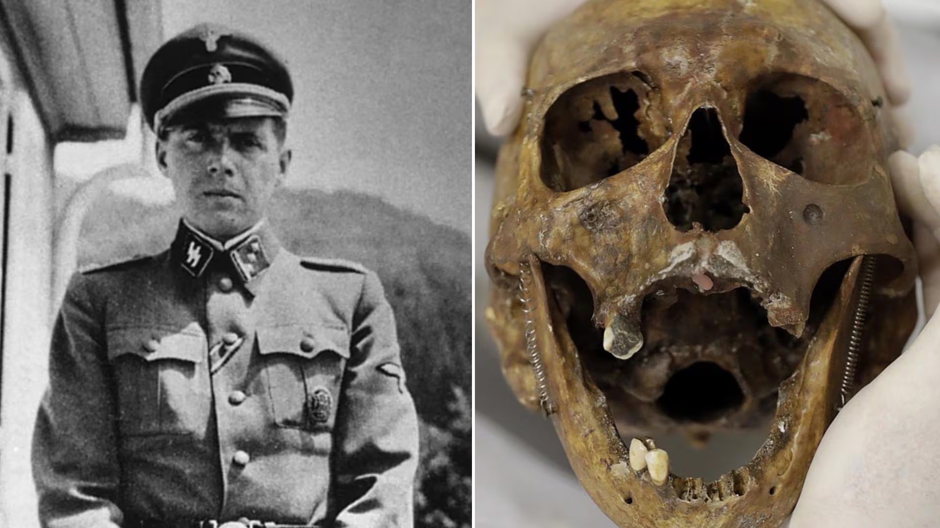 El espacio interdental entre sus dos paletas fue clave para identificar los restos de Mengele, que murió en Brasil en 1979 mientras nadaba en una playa de San Pablo