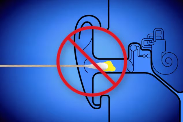 El cerumen cumple una función protectora y lubricante en el canal auditivo, y su presencia no significa una falta de higiene personal