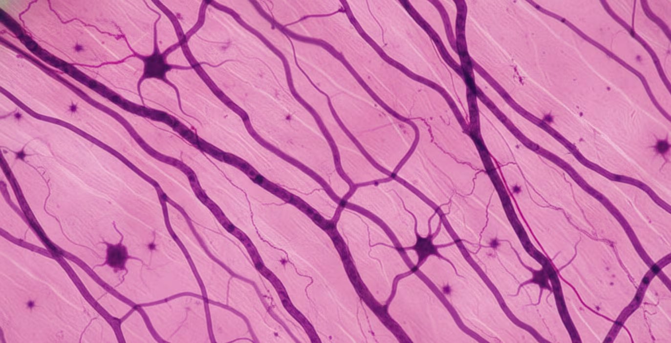 La atención a los tejidos conectivos transforma la prevención de lesiones y eleva el estándar de preparación física en atletas de élite (Imagen Ilustrativa Infobae)