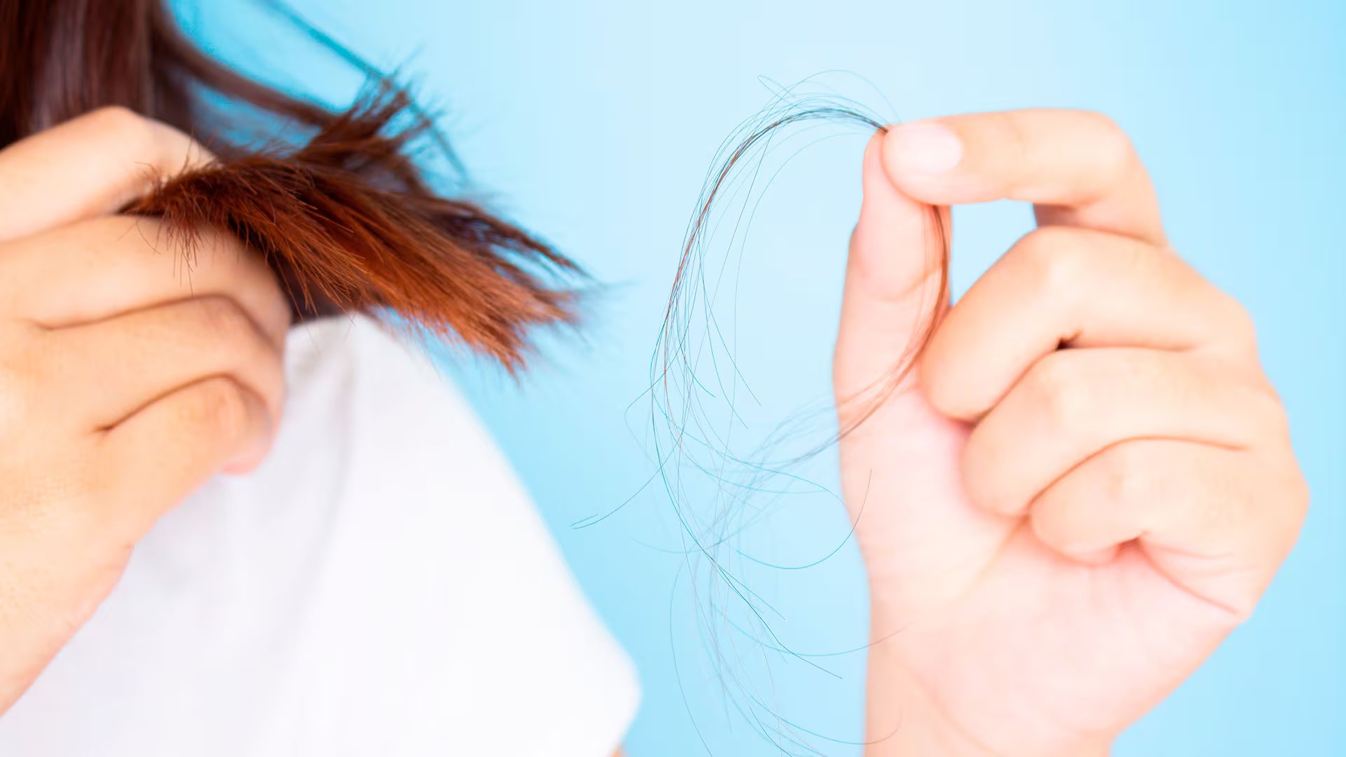 La evidencia científica respalda nuevas alternativas para frenar la caída del cabello y mejorar la autoestima de quienes lo padecen (Shutterstock)