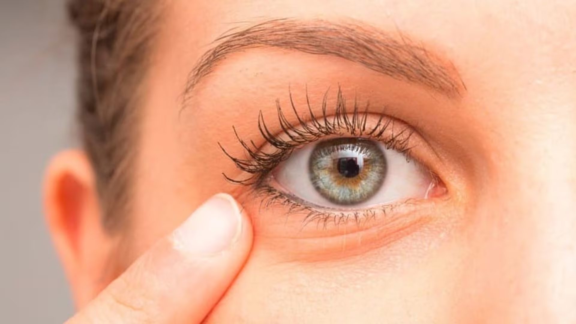 Las bolsas en los ojos son una hinchazón en los párpados inferiores ocasionada por debilidad de los tejidos y acumulación de líquidos.
(Sesderma/ Instagram)