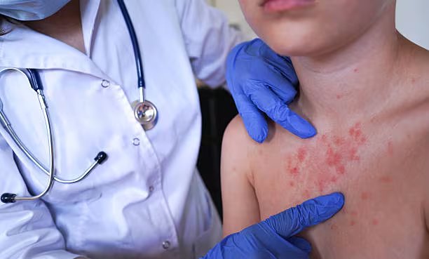 Los cuidados en casa deben incluir algunas medidas como la higiene, la alimentación, el descanso y la vigilancia de signos vitales. Foto: (iStock)