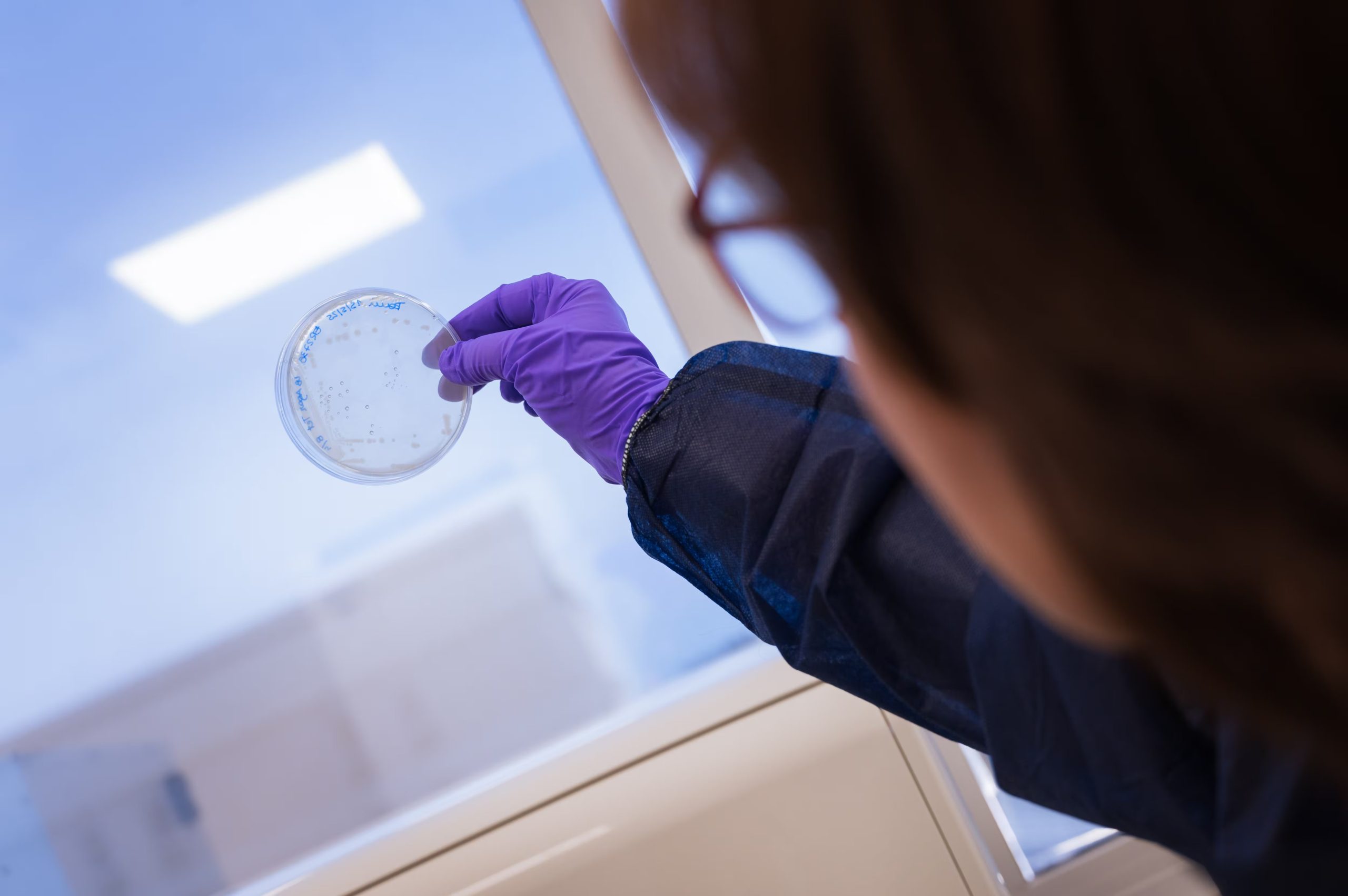 Muestra de un cultivo de bacterias (CSIC)