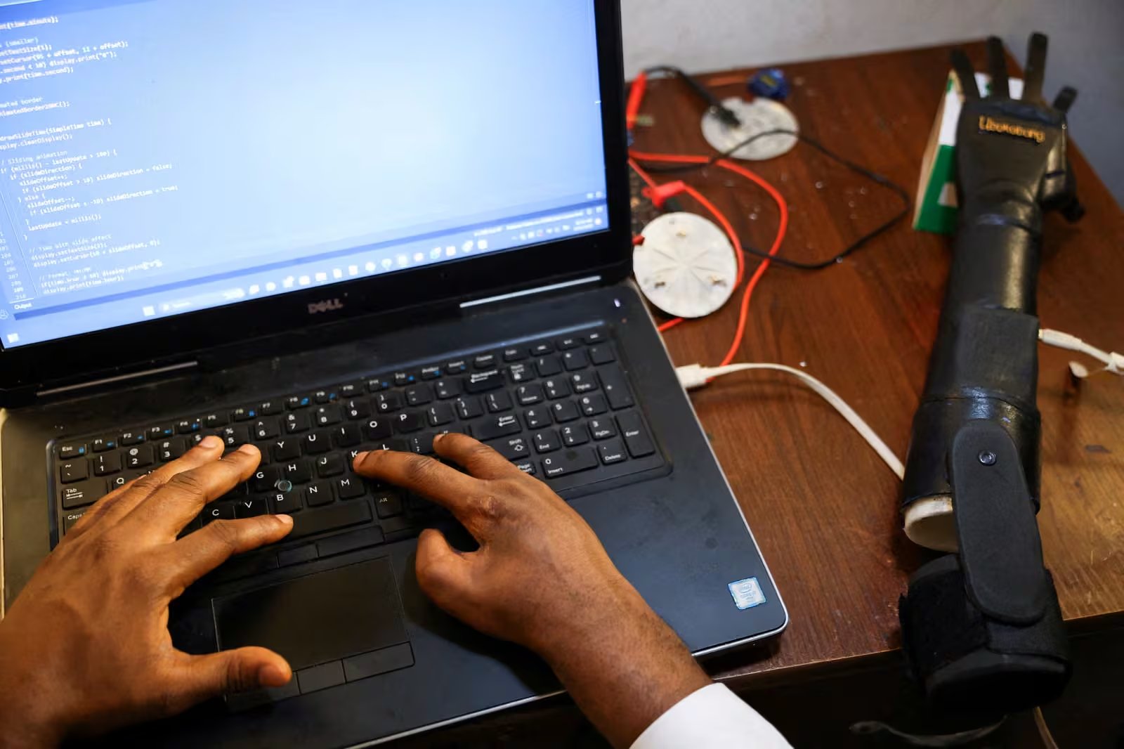 Según el Observatorio Mundial de la Salud, la mayoría de personas en países como Nigeria no puede obtener prótesis por razones económicas, y la adaptación cultural y tecnológica es clave para mejorar el acceso y la calidad de vida (Sodiq Adelakun/Reuters)