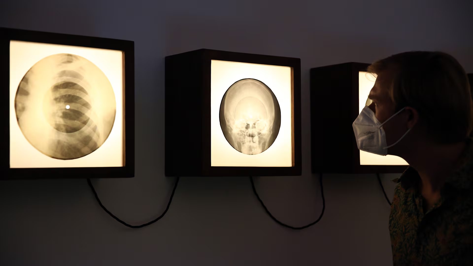 Una exhibición muestra cómo eran los discos precariamente grabados en placas radiográficas