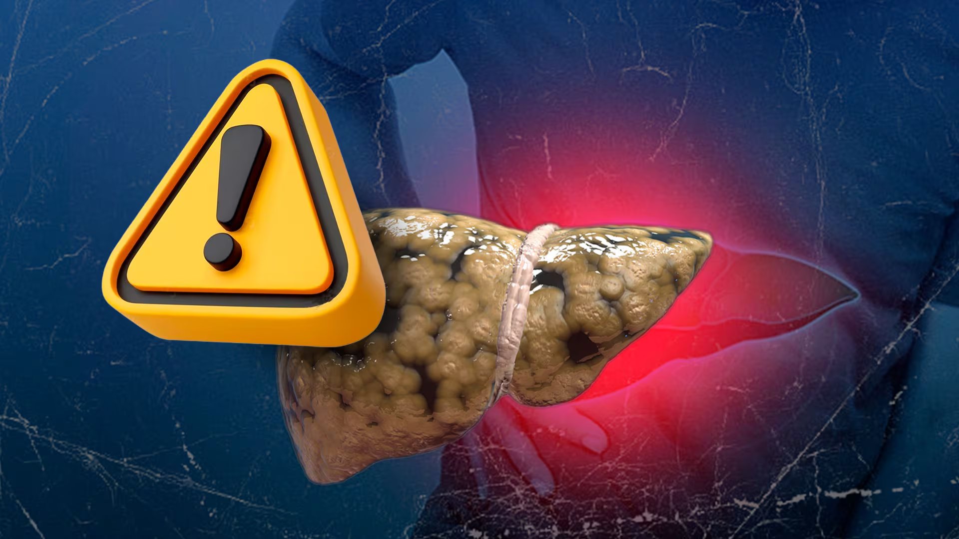 Daños severos o prolongados pueden impedir que el hígado se recupere completamente.
(Foto: Infobae México/ Jesús Aviles)