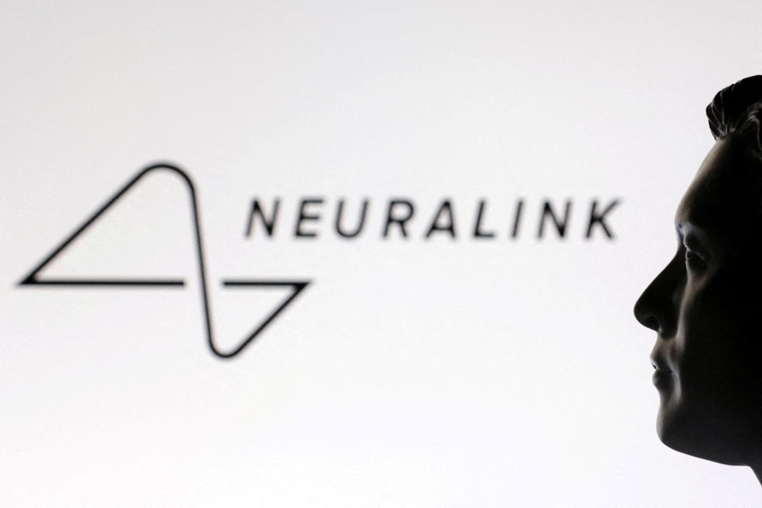 La tecnología de Neuralink busca que personas con lesiones medulares o parálisis puedan interactuar con dispositivos mediante la intención de movimiento. REUTERS/Dado Ruvic/Illustration/File Photo