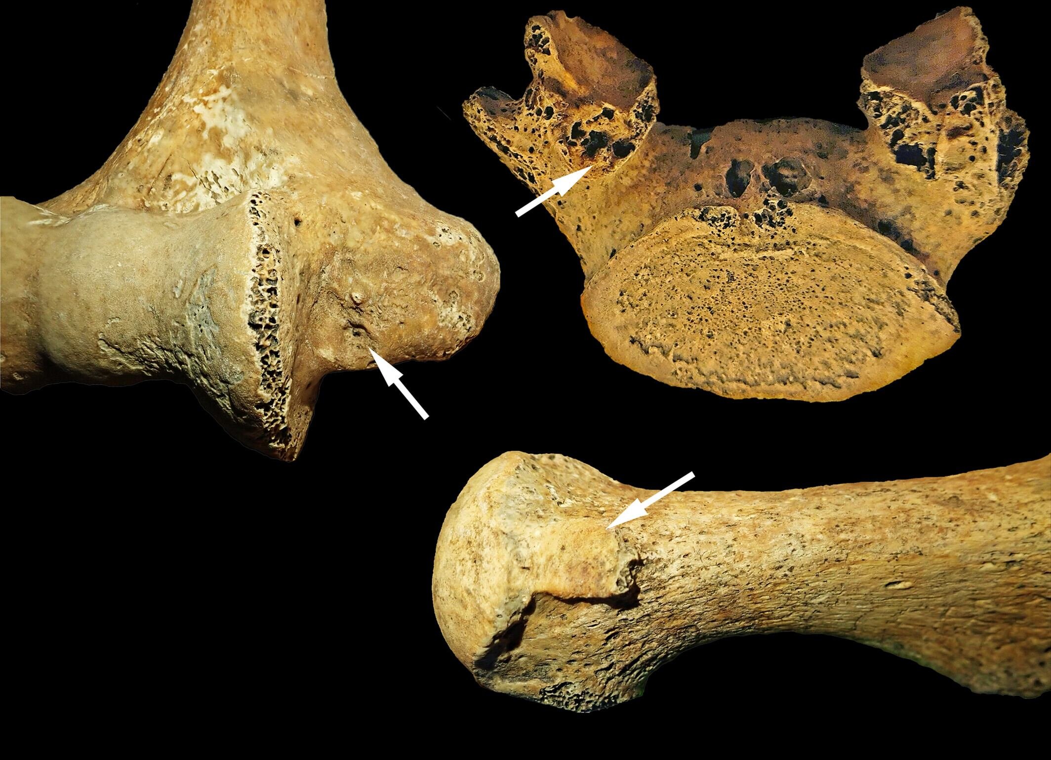 Ilustración de los cambios esqueléticos relacionados con la actividad registrados en este estudio. (CNRS)