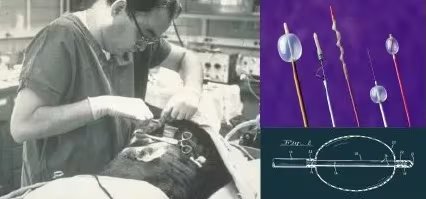 El catéter de balón ideado por Thomas Fogarty revolucionó la cirugía vascular al permitir la extracción de coágulos sanguíneos sin procedimientos invasivos (Créditos: Fogarty Innovation)