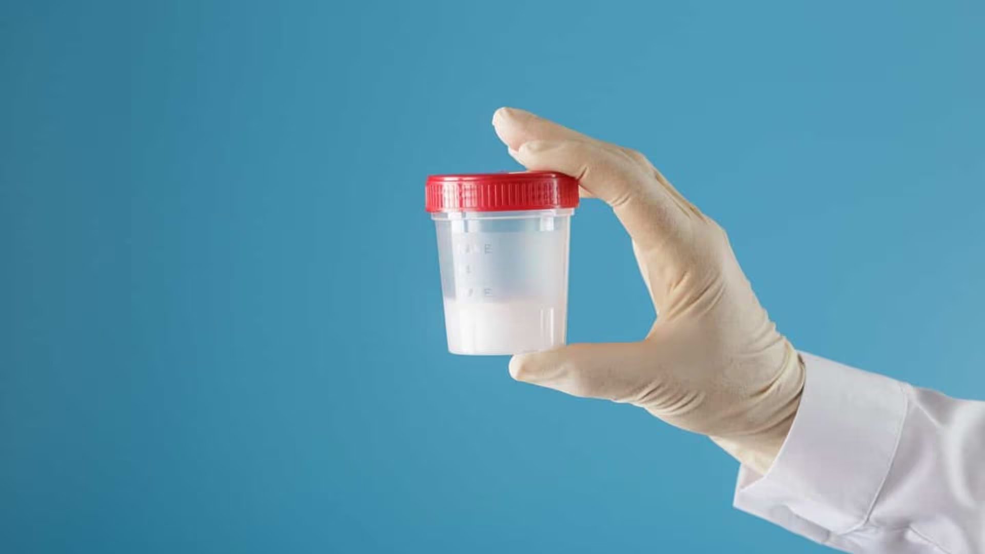 Qué determina realmente la calidad seminal

(Forum Libertas)