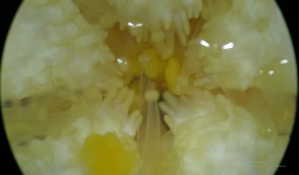 El proceso reproductivo consiste en incubar a las crías dentro del estómago y liberarlas por la boca una vez completado su desarrollo (CONICET)