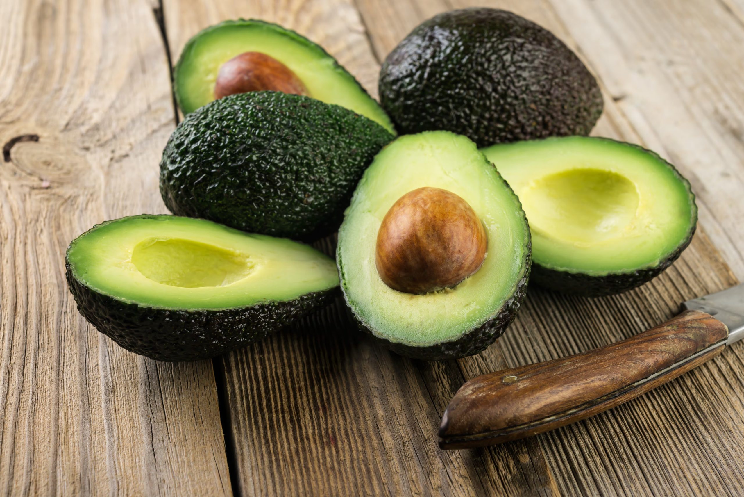 Los beneficios del aguacate (AdobeStock)