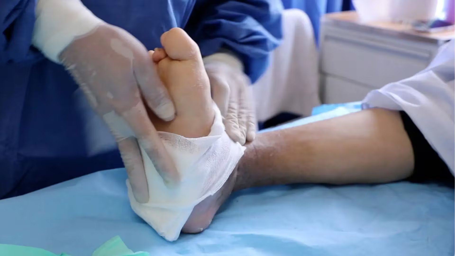 Pie diabético: la complicación de la diabetes que puede llevar a la pérdida de extremidades. (Foto: Agencia Andina)