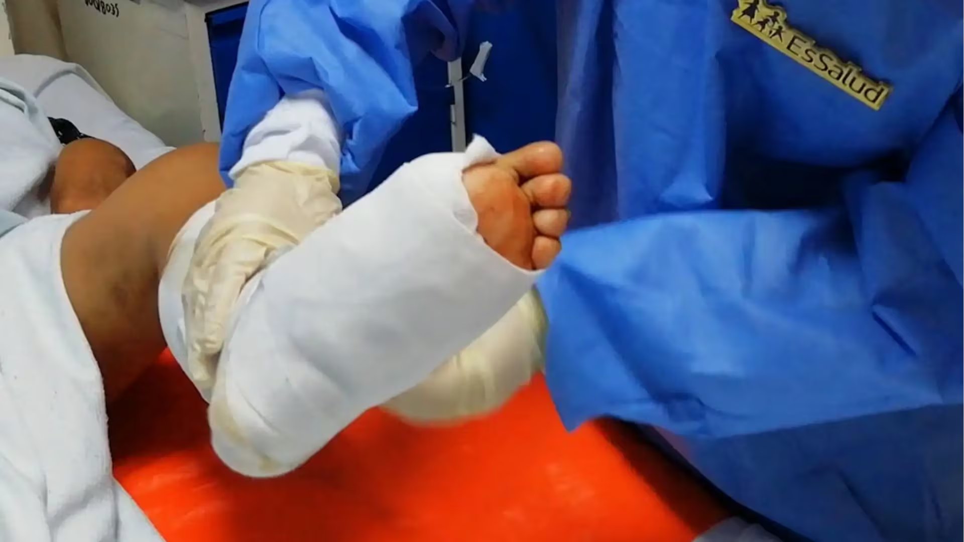 Diabetes mal controlada aumenta hasta en 80% el riesgo de lesiones graves en los pies. (Foto: Agencia Andina)