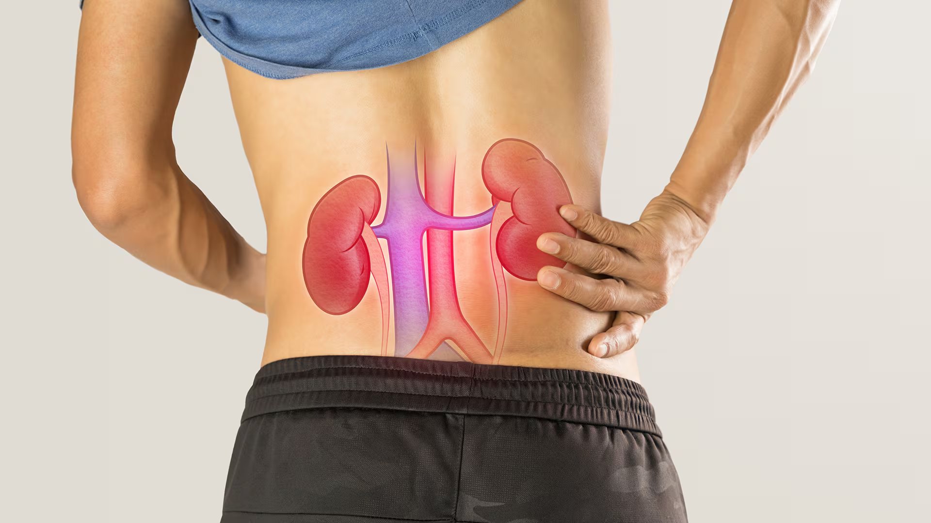 El consumo regular de jugo de limón ayuda a prevenir la formación de cálculos renales gracias a su efecto sobre la excreción de citrato (Freepik)