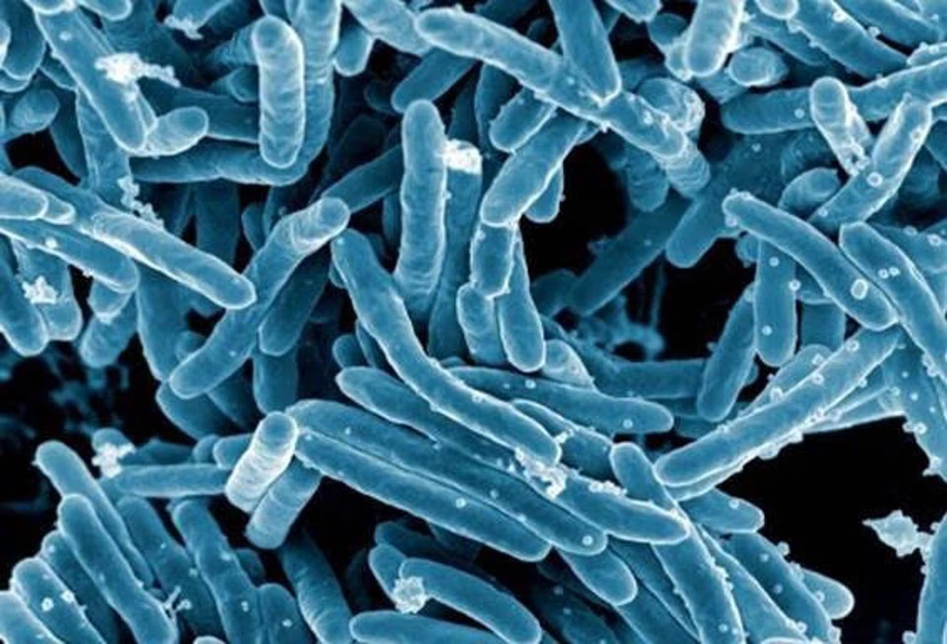 La tuberculosis es provocada por la bacteria Mycobacterium tuberculosis, que afecta principalmente los pulmones./
NIAID
