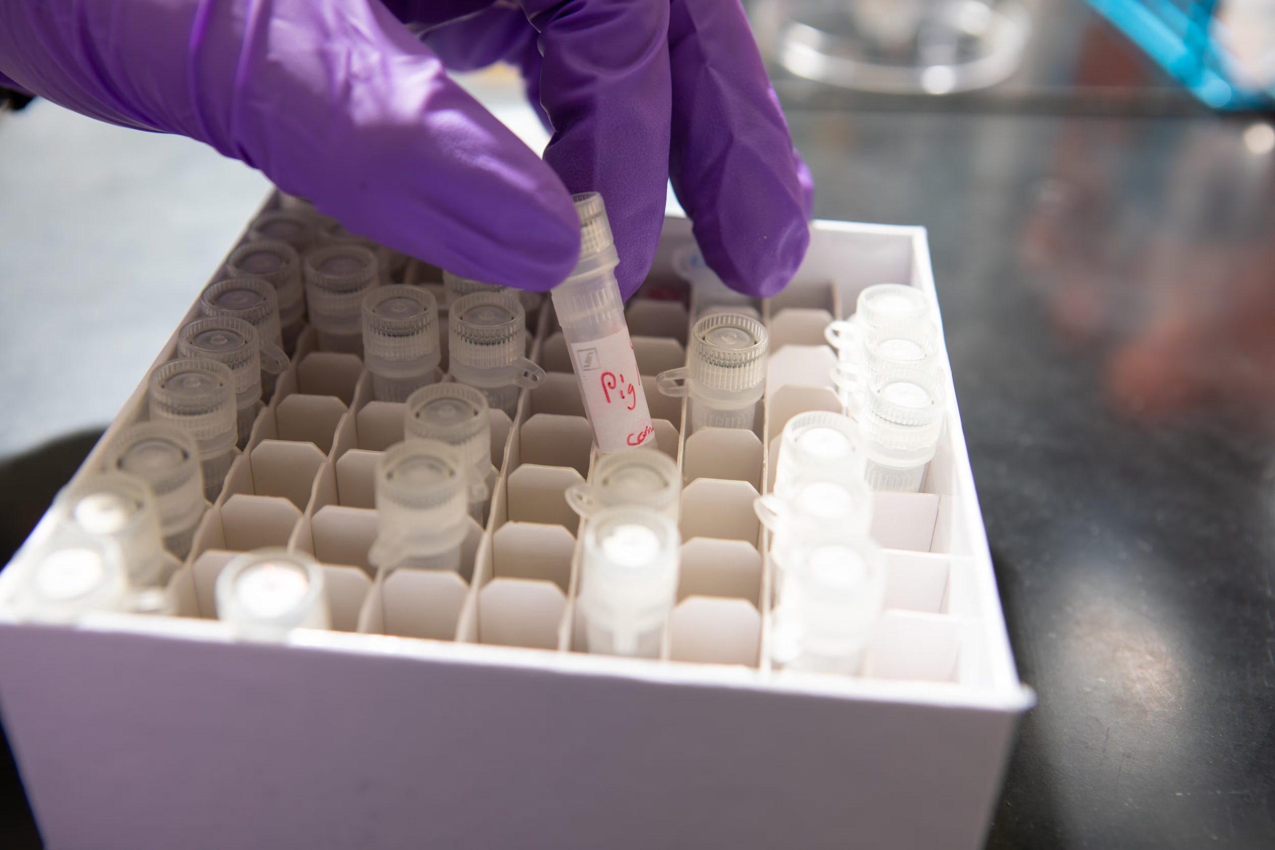 La prueba molecular Xpert MTB/RIF Ultra aplicada en saliva mostró una sensibilidad del 90,5% y una especificidad del 95,8% en la detección de tuberculosis./Archivo School of Dental Medicine in Foster Hall

Photographer: Douglas Levere