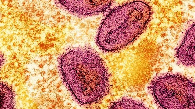 La circulación del clado Ib de mpox preocupa por su mayor severidad y contagiosidad respecto a otros subtipos de la enfermedad / NIAID/Handout via REUTERS/Foto de archivo