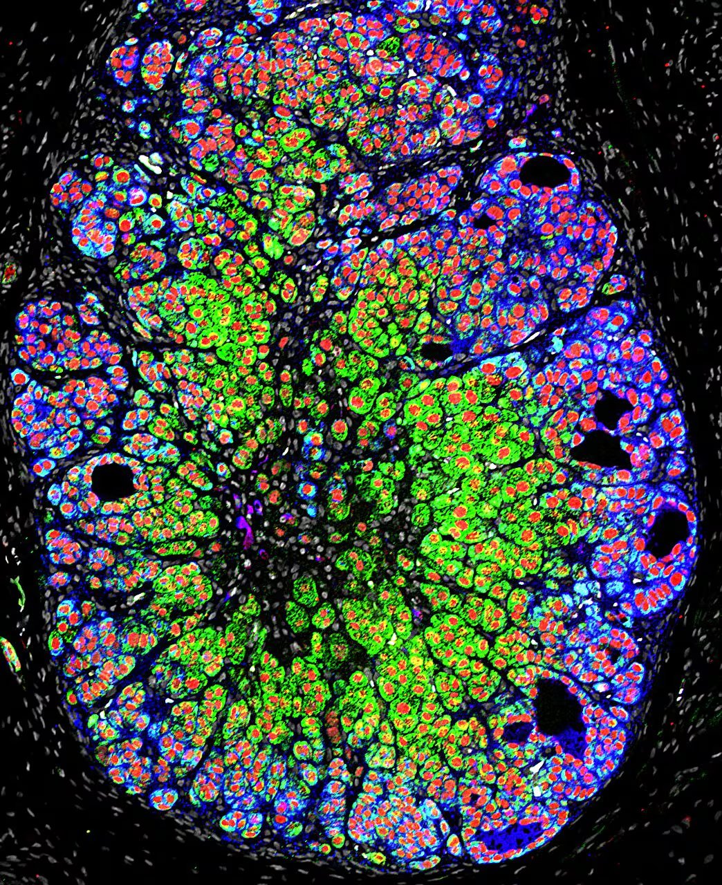 Científicos en Filadelfia lograron crear una mini glándula suprarrenal humana funcional en una placa de Petri (Michinori Mayama, Universidad de Pensilvania)