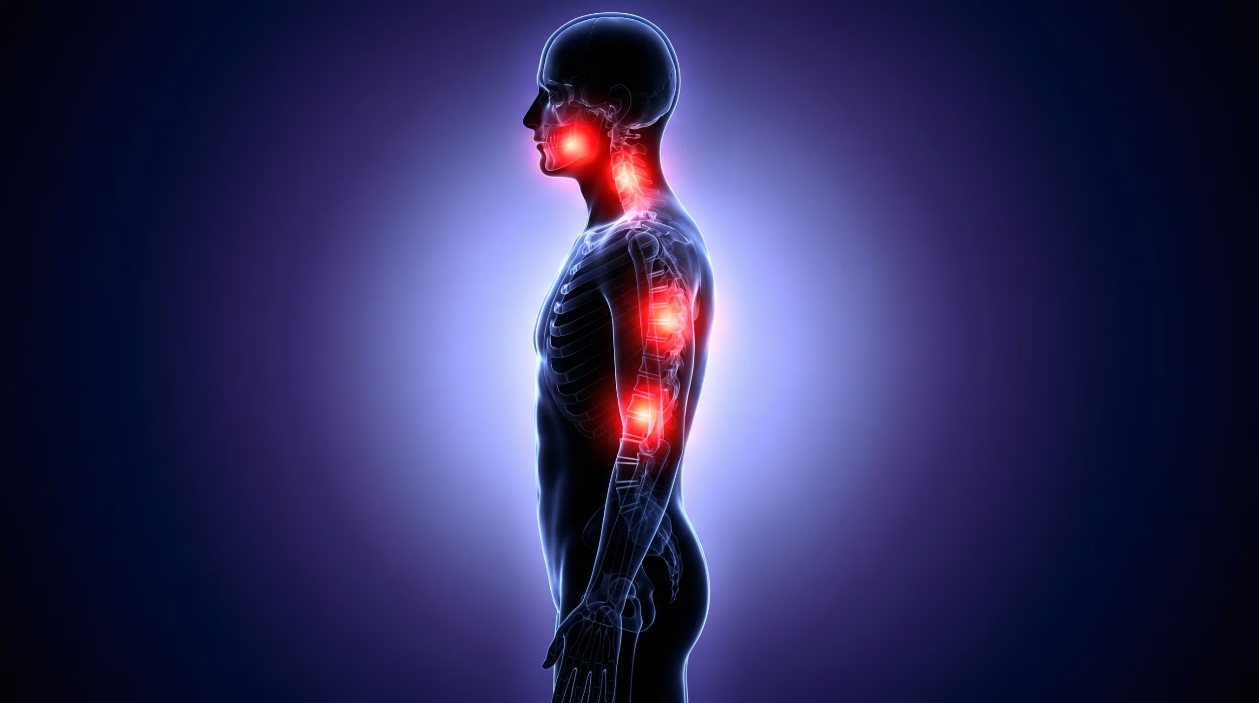 El dolor que se irradia hacia el brazo izquierdo, la mandíbula o la espalda es típico de un infarto, por lo que consultar a emergencias es fundamental para la salud cardíaca (Imagen Ilustrativa Infobae)