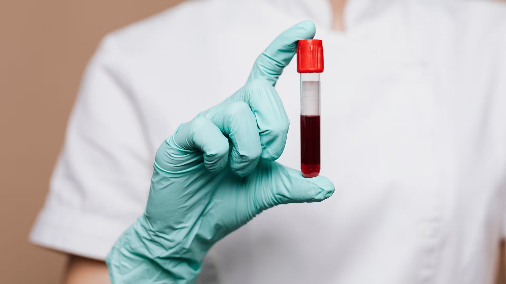 El Chagas se diagnostica mediante análisis de sangre que detectan la presencia del parásito Trypanosoma cruzi o sus anticuerpos (Freepik)