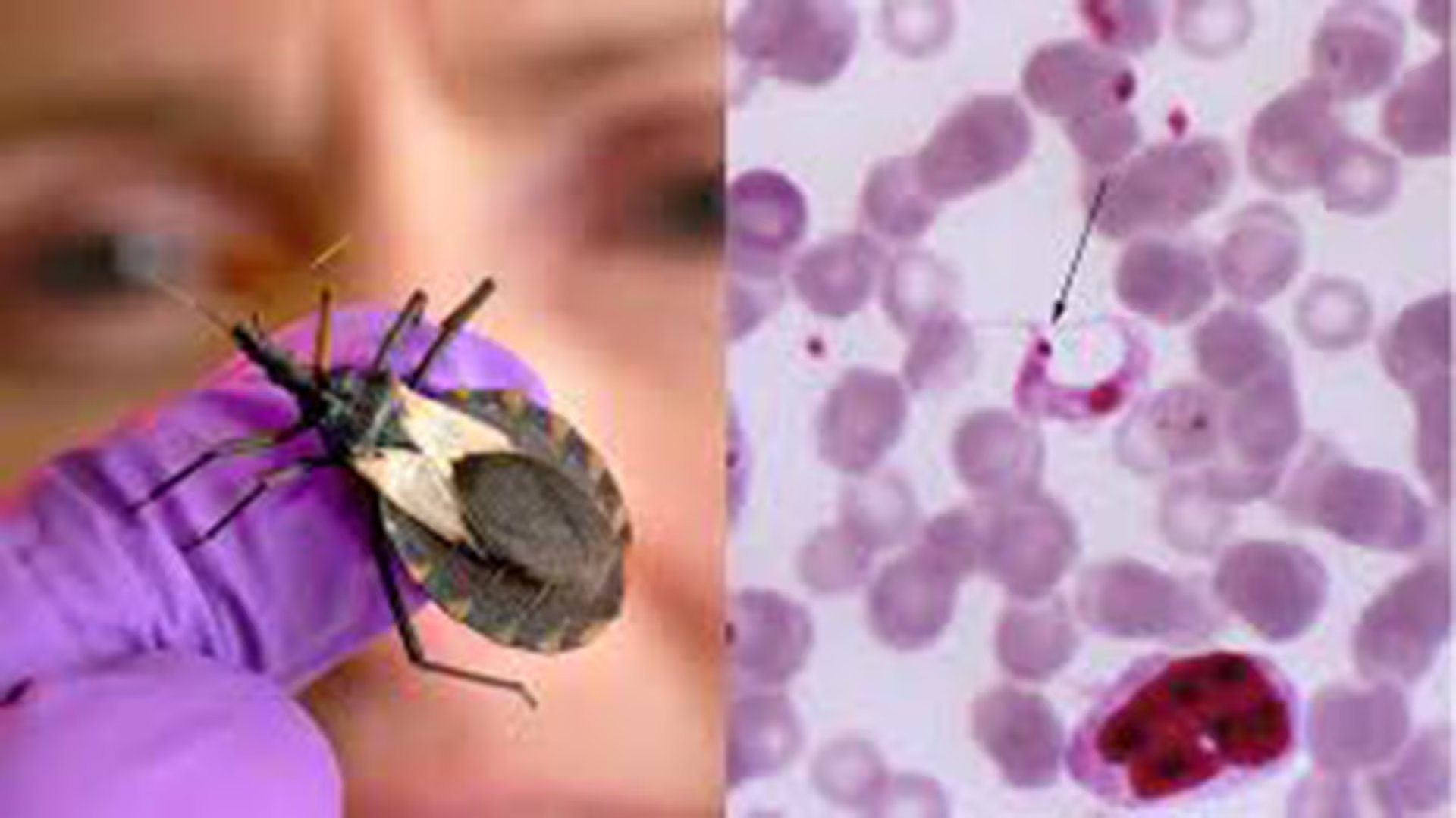 La colaboración internacional permite abordar el Chagas desde distintas realidades regionales/Archivo CDC